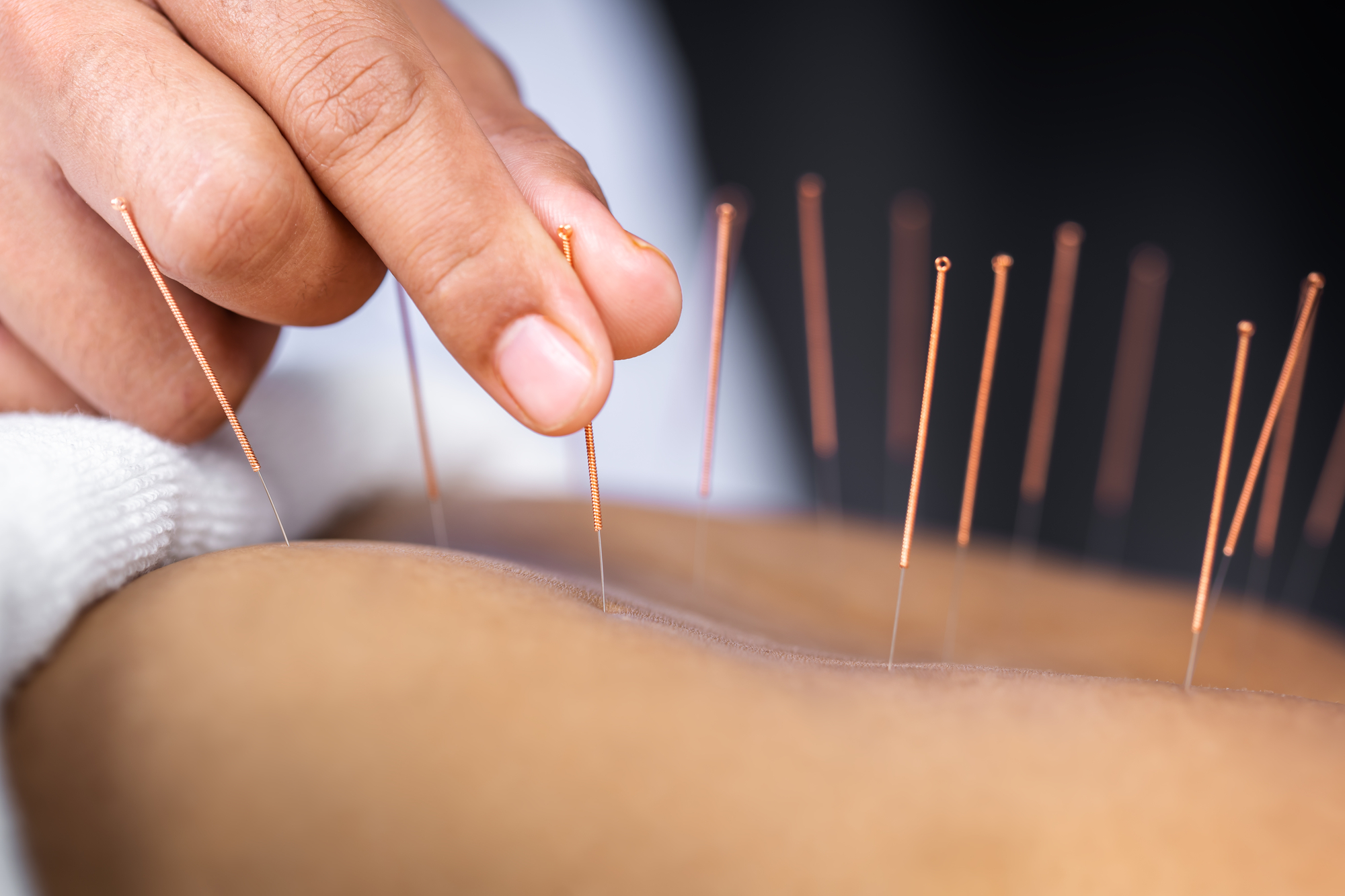 Acupuncture for Winter